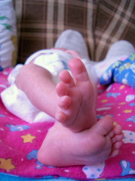 Ножки в 3 недели. Лиза 0 - 2 года