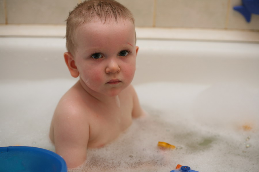 Еще один длинный день позади. Теперь со шрамом