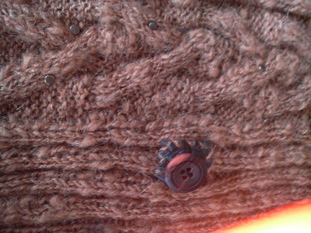 Пуговицы пришиты на кожу. 