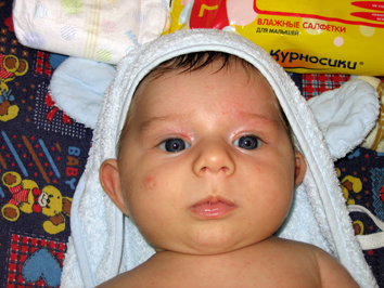 Ушастик. Ушастик