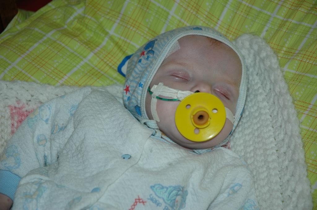 До операции. Марина