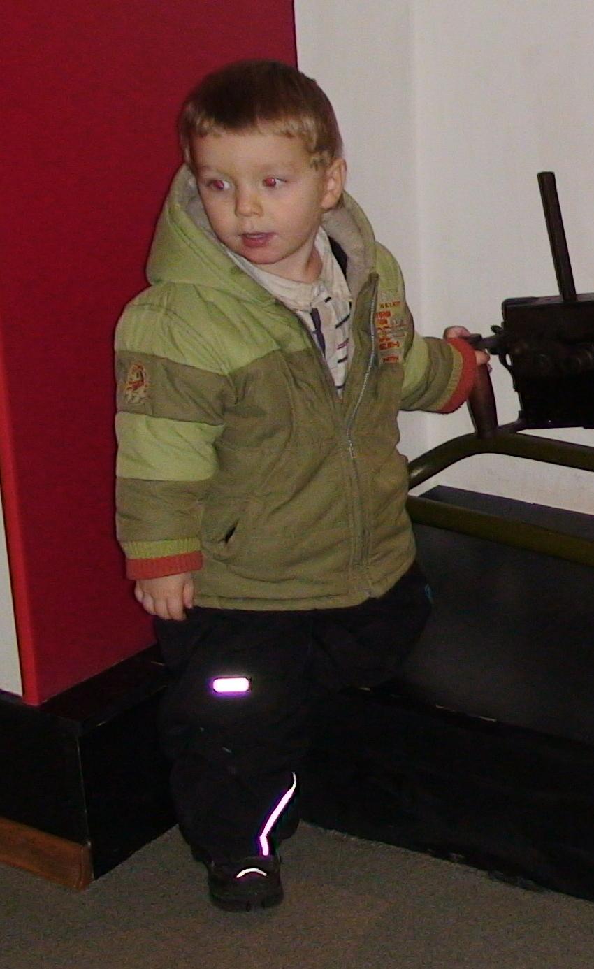 Боболи на ребенке. вехняя одежда