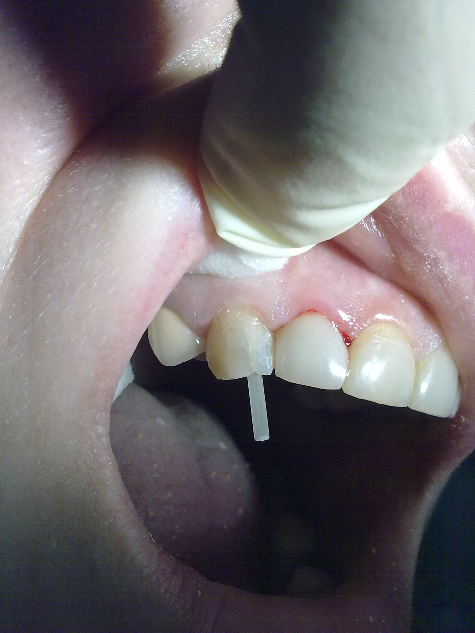 СТОМАТОЛОГИЯ-терапия