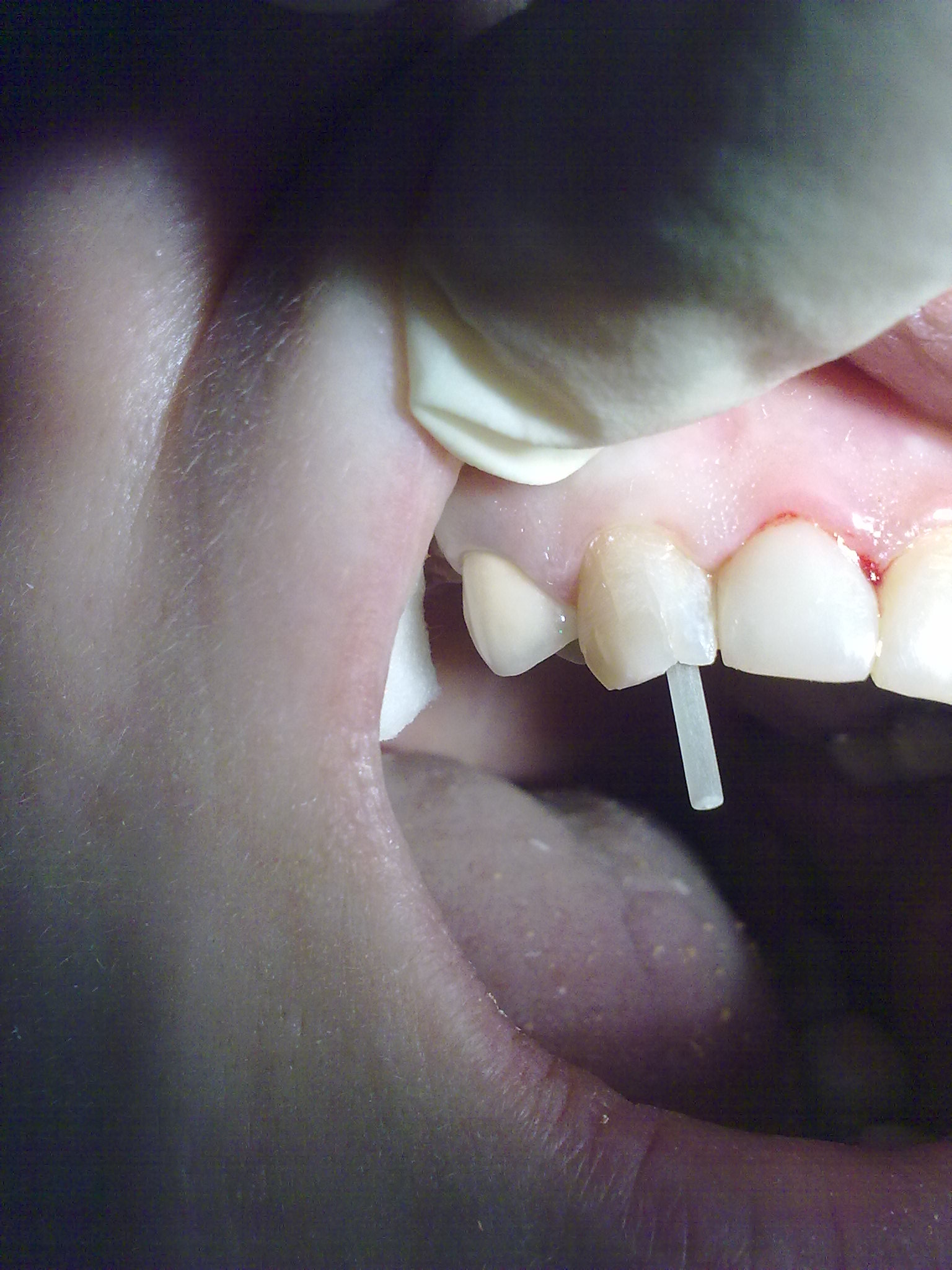 СТОМАТОЛОГИЯ-терапия