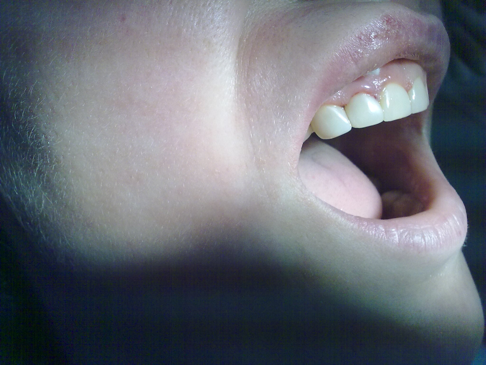 СТОМАТОЛОГИЯ-терапия