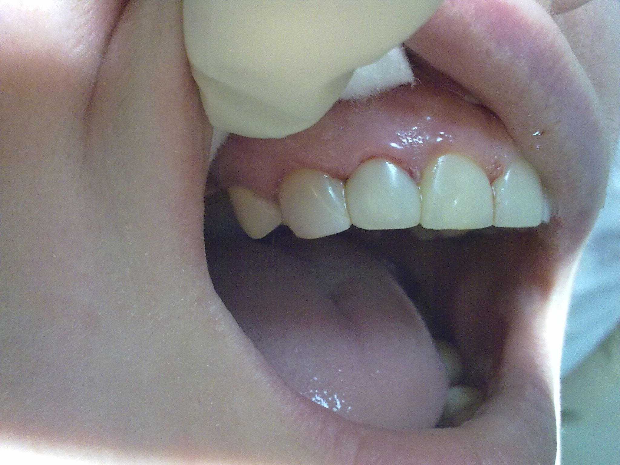 СТОМАТОЛОГИЯ-терапия