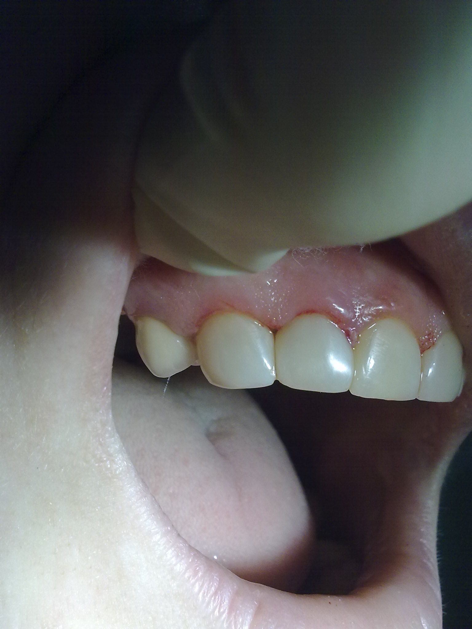 СТОМАТОЛОГИЯ-терапия