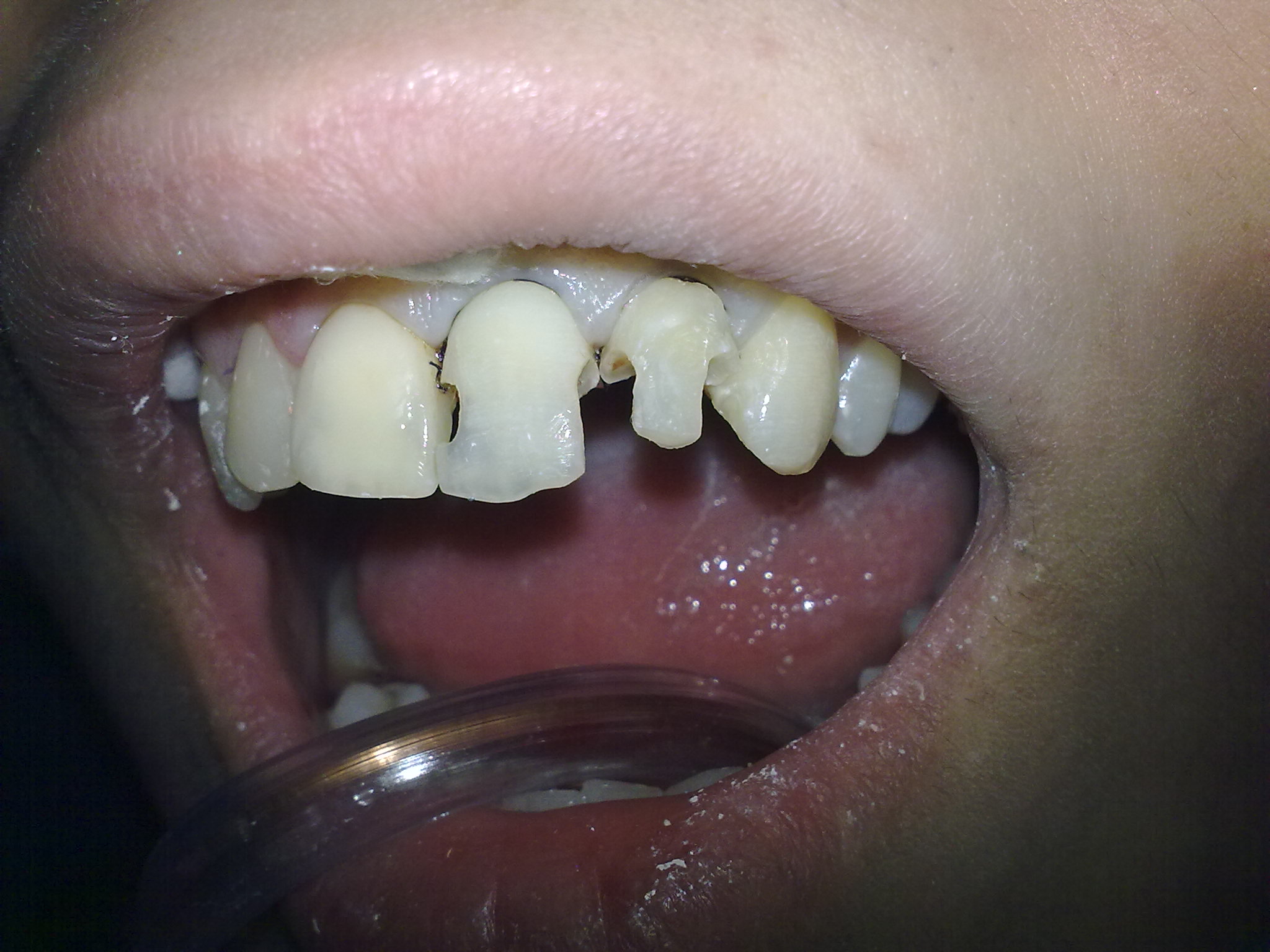 СТОМАТОЛОГИЯ-терапия