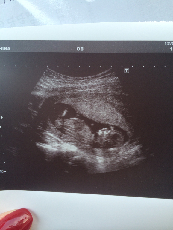 пристроено