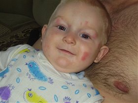 Комаррыыыы поели