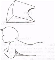Рис. 8.1.   Маленький клин для груди. Особенно удобен для детей с тяжелыми двигательными нарушениями (а, б}.
