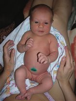 зеленый пупок