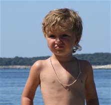 Ромка. Видно состояние шва и грудной клетки...