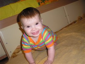 Голливудская улыбка! Все 2 зуба