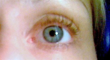 После 1 месяца применения